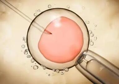 试管婴儿胚胎移植费用多少，流程有哪些
