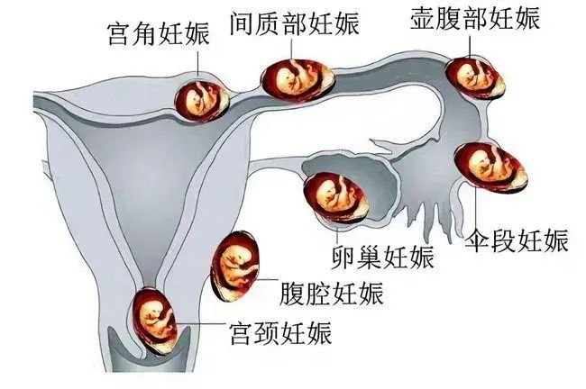 泰国全球殖中心介绍，WORLDWIDE助孕优势及成功率都在这